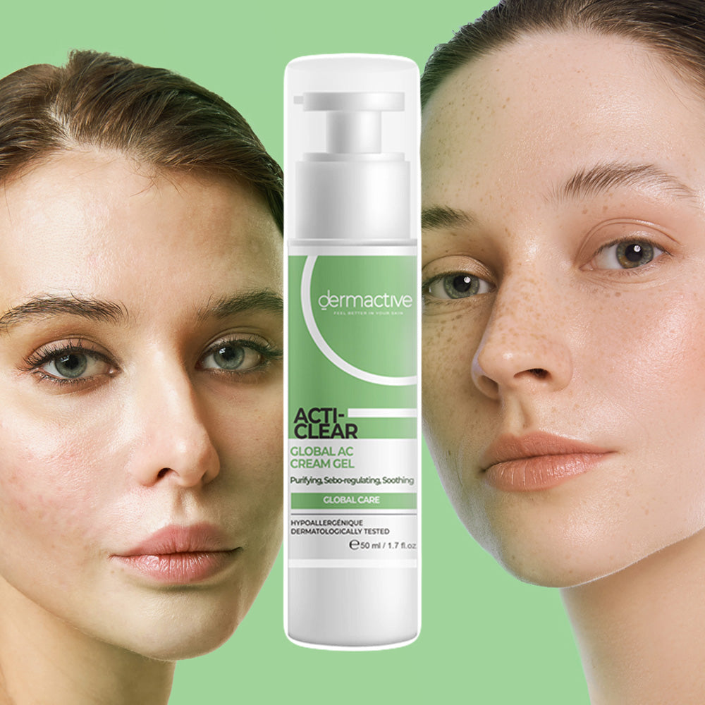 ACTI-CLEAR Global AC Cream